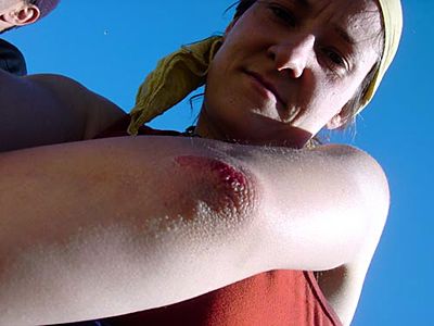 ella-unfall.jpg
